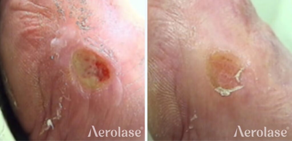 67a08984972751caf470ff2e_111ulcers-1-drjuliettehepburn-before-and-after